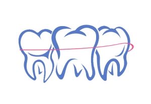 Dental Plates